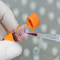 تشخیص اوتیسم با آزمایش خون
