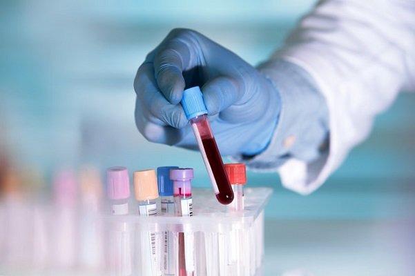 تخمین باقیمانده عمر با آزمایش خون !