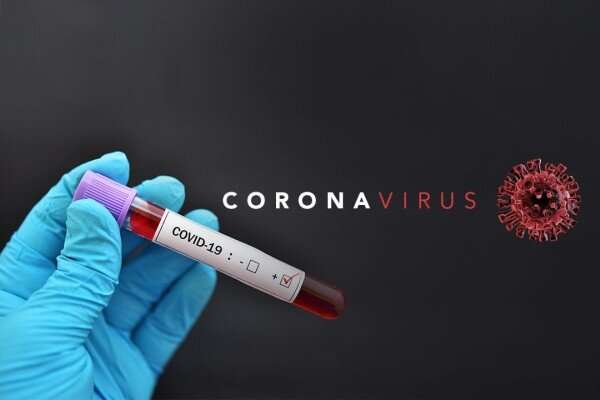 ساخت دارویی که از تکثیر ویروس کرونا جلوگیری می‌کند