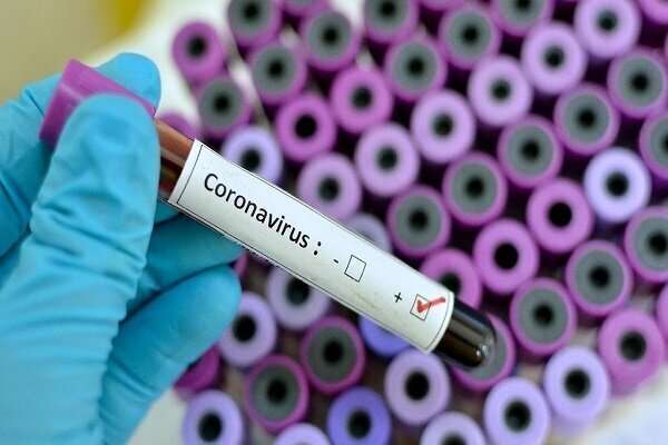 آزمایش ۳ دارو برای درمان کووید۱۹ متوقف شد