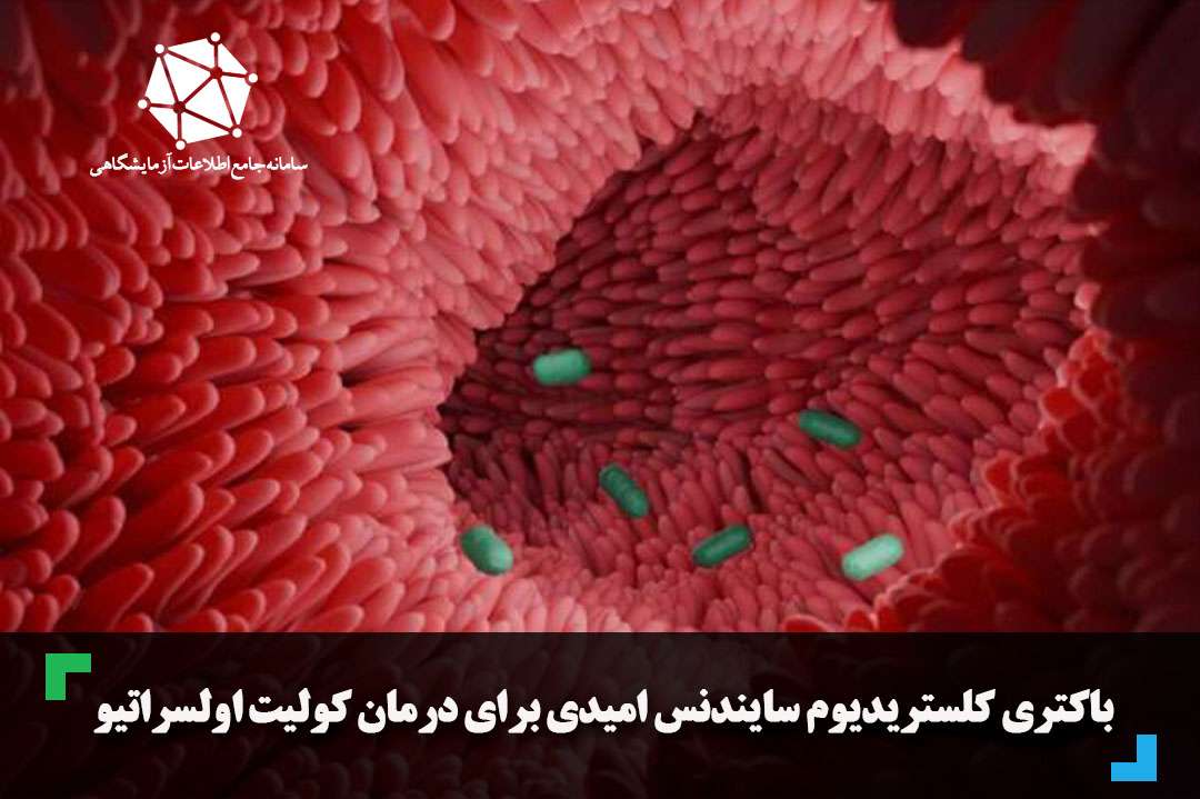 باکتری کلستریدیوم سایندنس امیدی برای درمان کولیت اولسراتیو