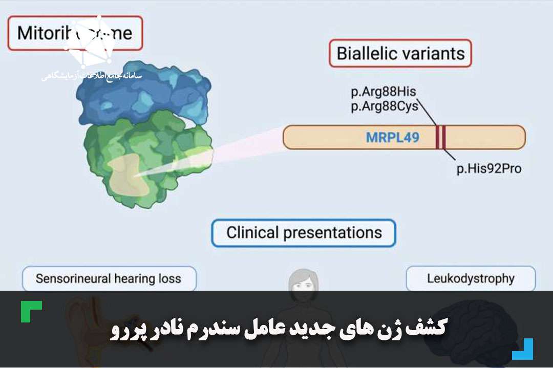 کشف ژن‌های جدید عامل سندرم نادر پررو